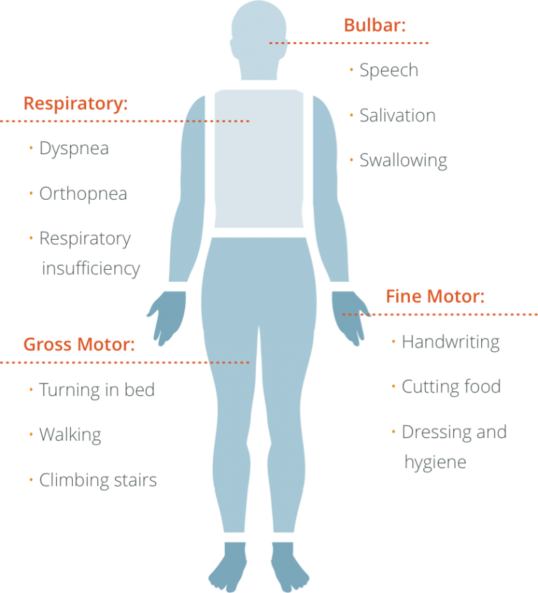 ALS Progression – ALS Testing | ALS Pathways