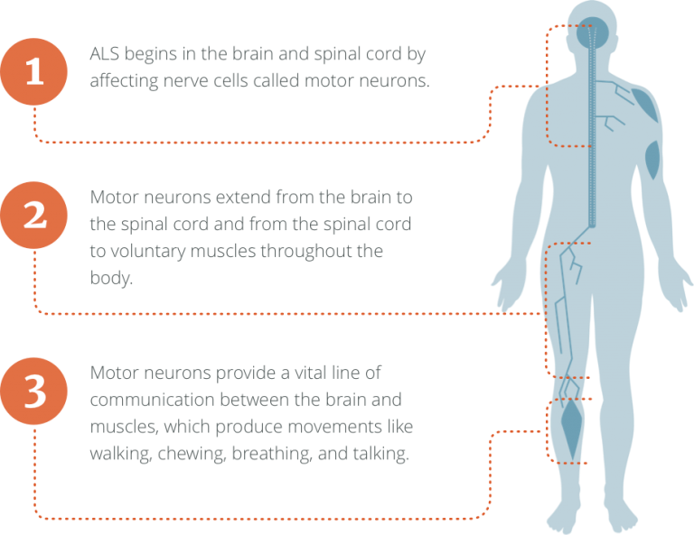 ALS Facts and Symptoms Overview | ALS Pathways